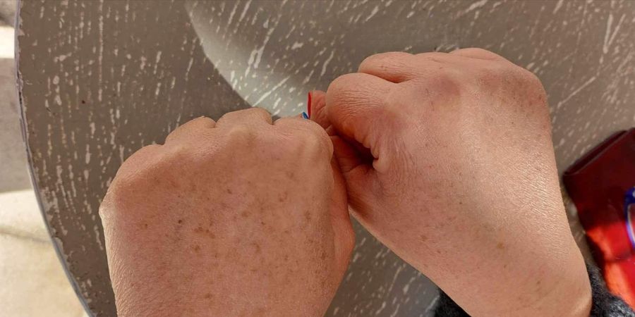 True Story: Amalia's Experience with Bioaromacrete's STIGMA Anti-Spot Day Cream