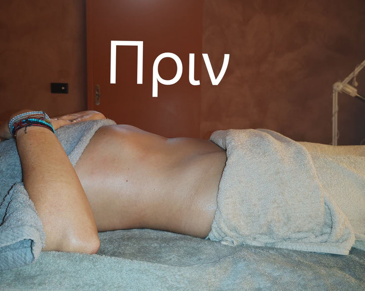 ARTION SPA RENALUX LYMPHATIC DRAINAGE