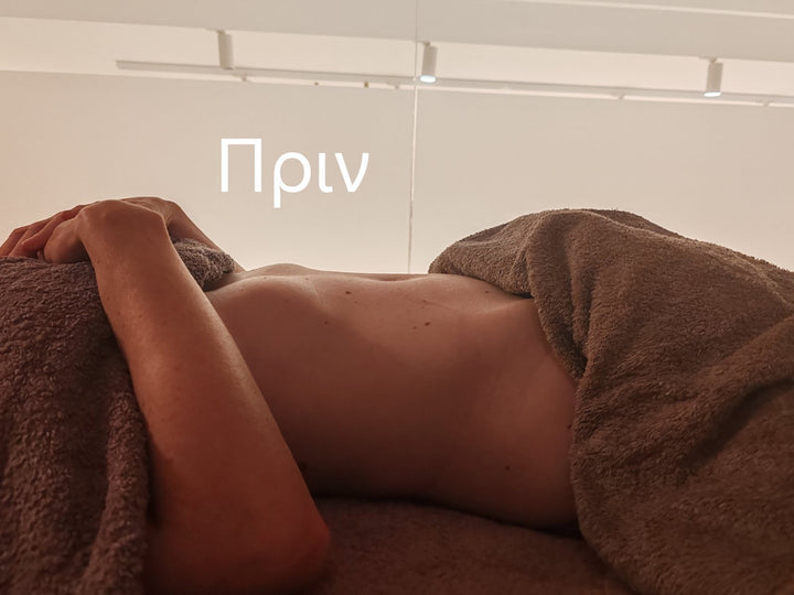 ARTION SPA RENALUX LYMPHATIC DRAINAGE